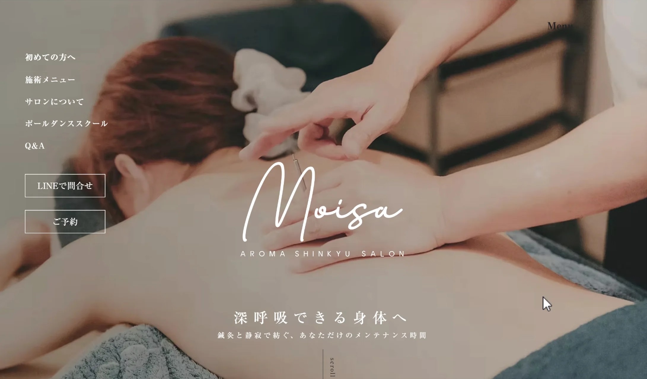 MOISAのFV